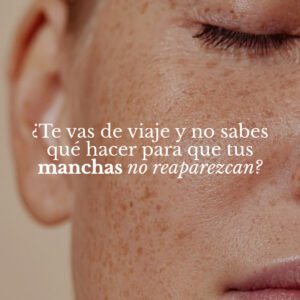Lee más sobre el artículo ¿Te vas de viaje y no sabes cómo cuidar tus manchas?