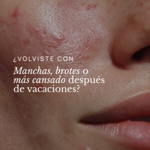 Lee más sobre el artículo ¿Volviste con manchas, brotes o más cansado de vacaciones?